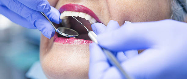 Best Emergency Tooth Extraction in Georgetown, GA